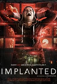 Implanted Implanted