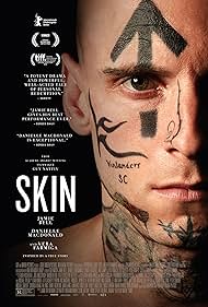 Skin Skin