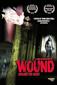 Wound Wound