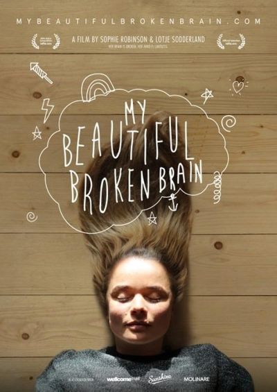 My Beautiful Broken Brain (2016)
